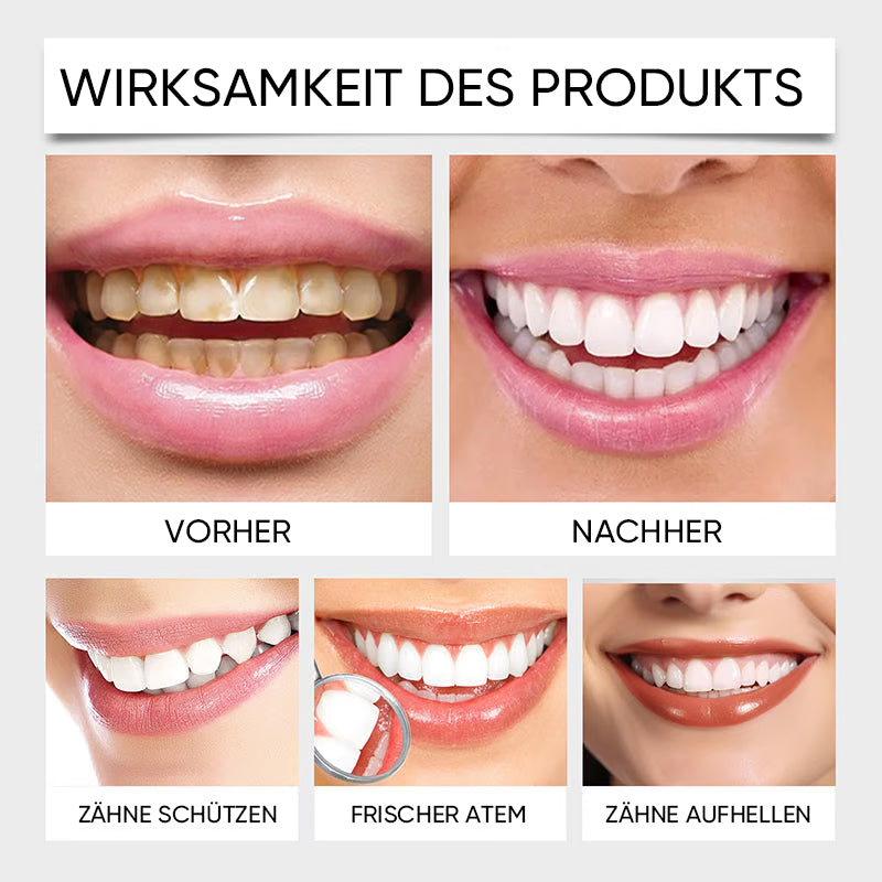 Hydroxylapatit-Zahnpasta zur Reparatur und Aufhellung der Zähne