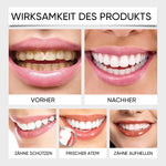 Hydroxylapatit-Zahnpasta zur Reparatur und Aufhellung der Zähne