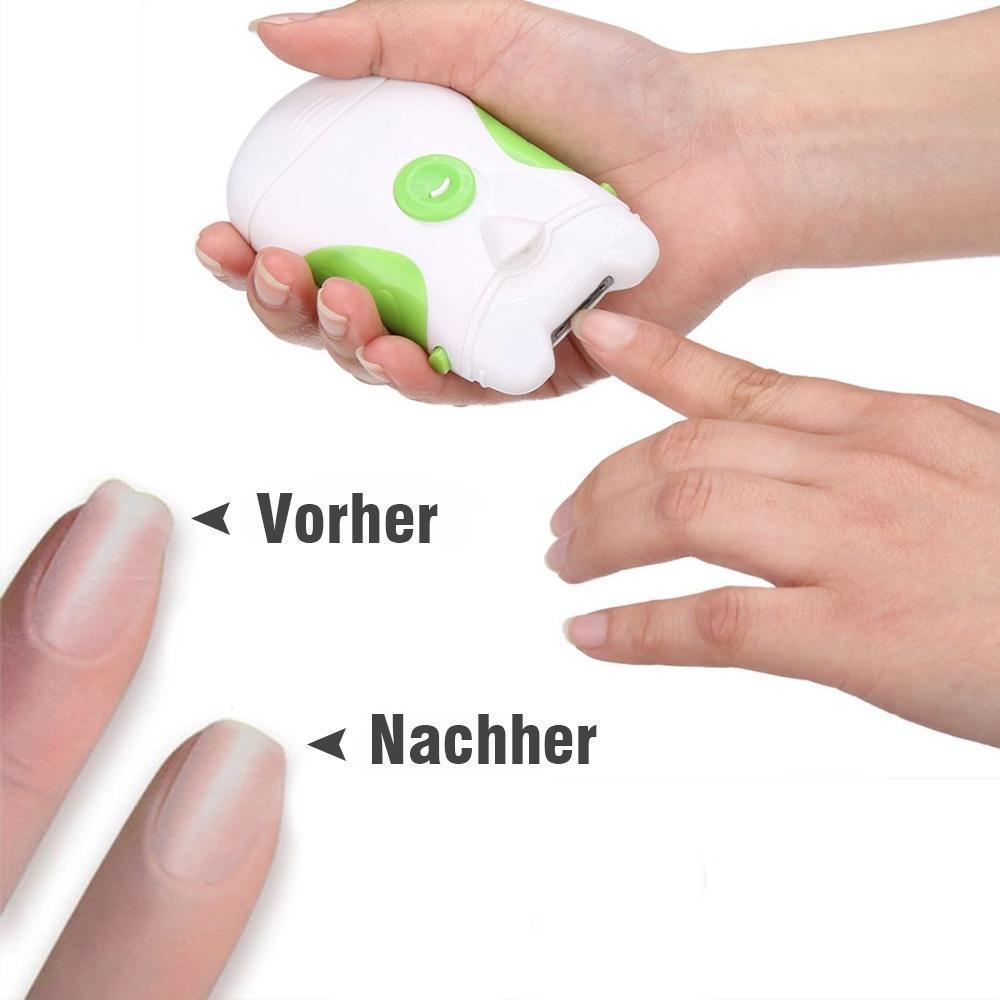 Bequee Elektrischer Nagelschneider mit LED-Licht - hallohaus